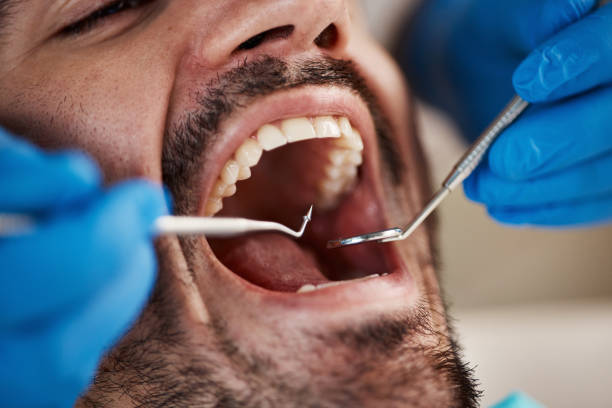 Best Pediatric Emergency Dentist in Munroe Falls, OH
